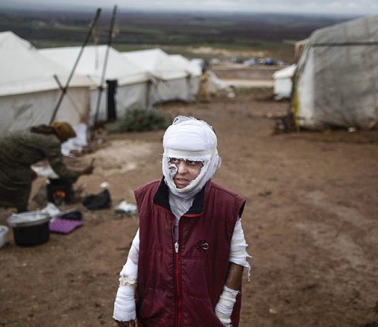 FN: Kjemiske våpen ble brukt i Syria
